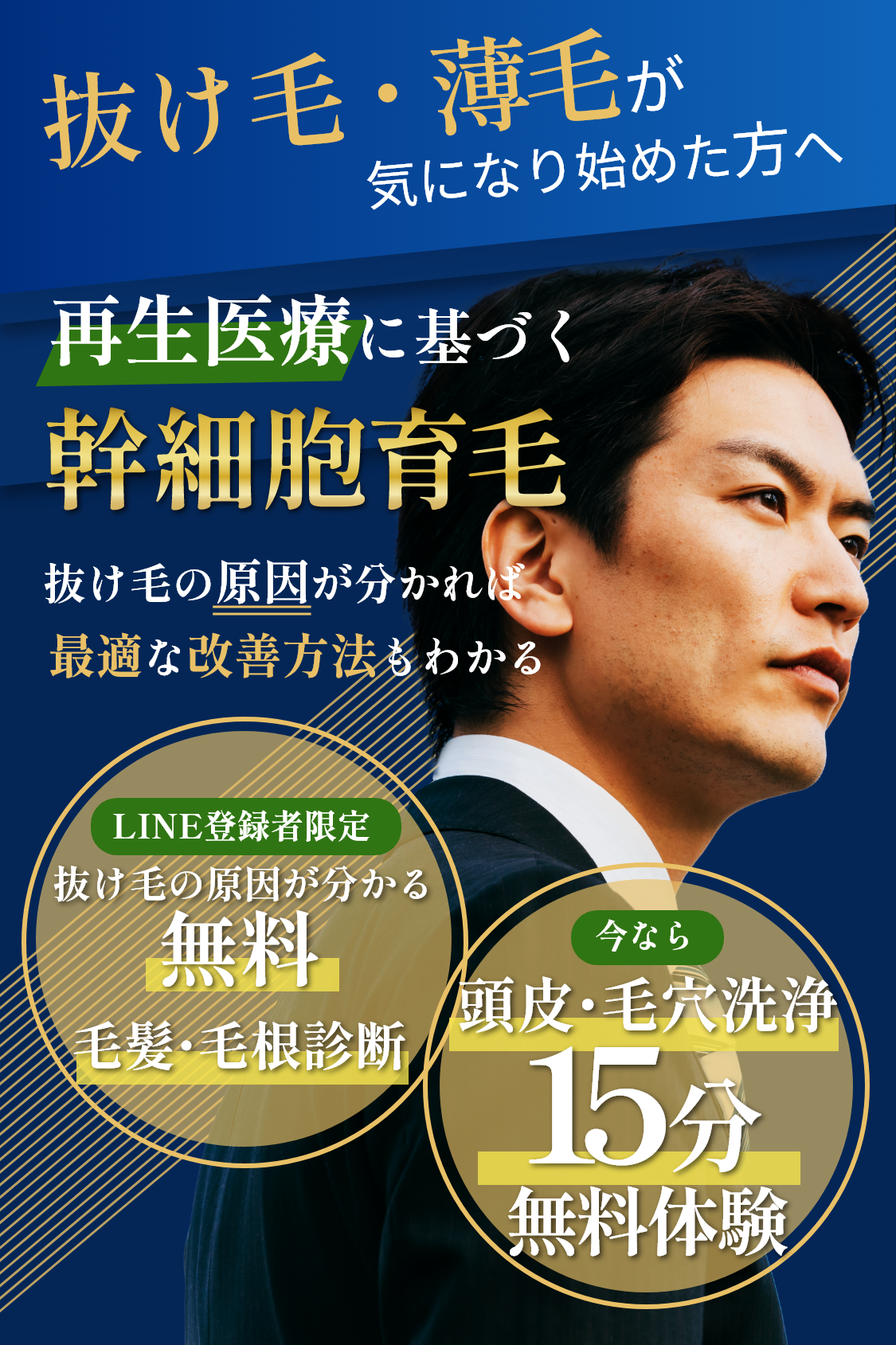 再生医療に基づく幹細胞育毛